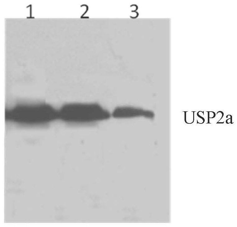 抗USP2a蛋白单克隆抗体杂交瘤细胞及其产生的抗USP2a单克隆抗体和应用