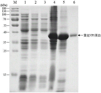 一种柯萨奇病毒A组19型VP1基因重组表达蛋白、多克隆抗体的制备方法及其应用